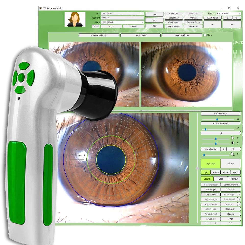 12MP Iriscope Camera YR-9822U